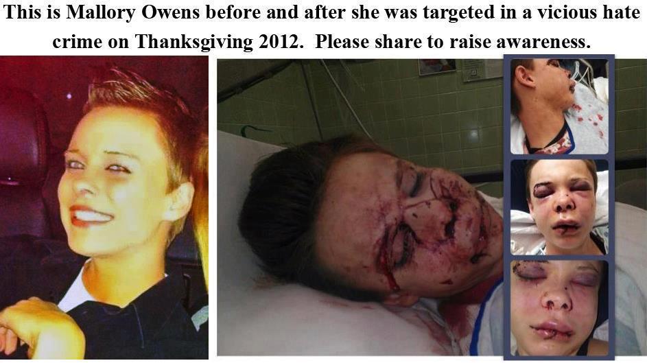 marciedavis:  youbitchesaremypeasants:  Mallory Owens, 23, was beaten within an inch