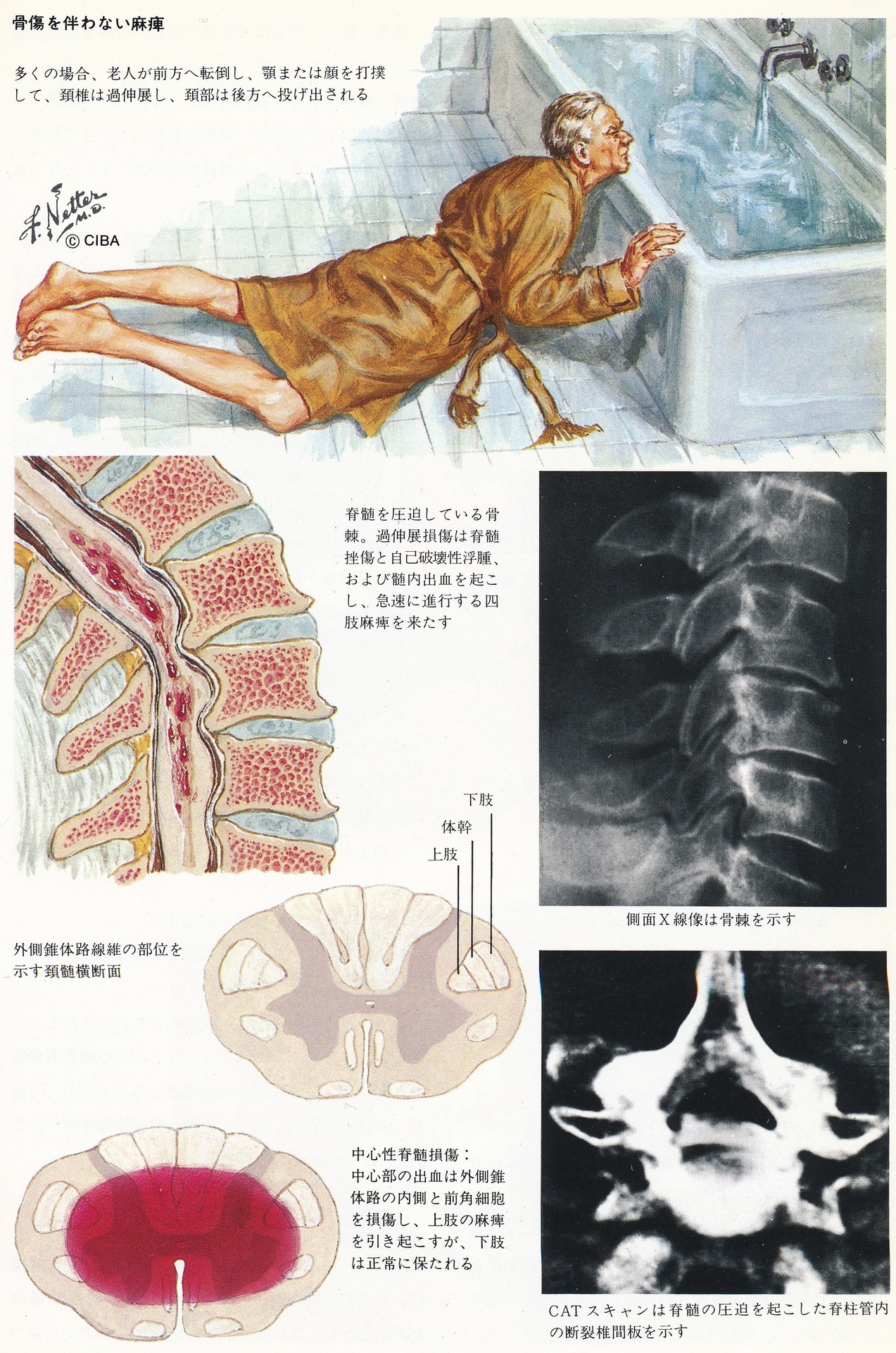 Public Collectors Illustrations By Frank Netter Scanned From