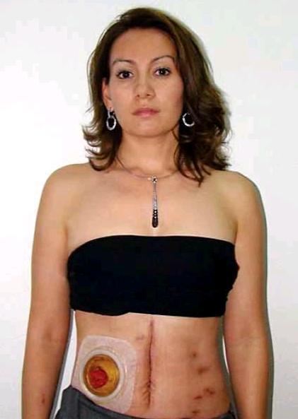 obitoftheday:  Obit of the Day: Tiquicheo’s Fearless Mayor Maria Santos Gorrostieta became mayor of the town of Tiquicheo in 2009, when she was only 33 years old. She recognized the risks as her town was located in the state of Michoacan one of the