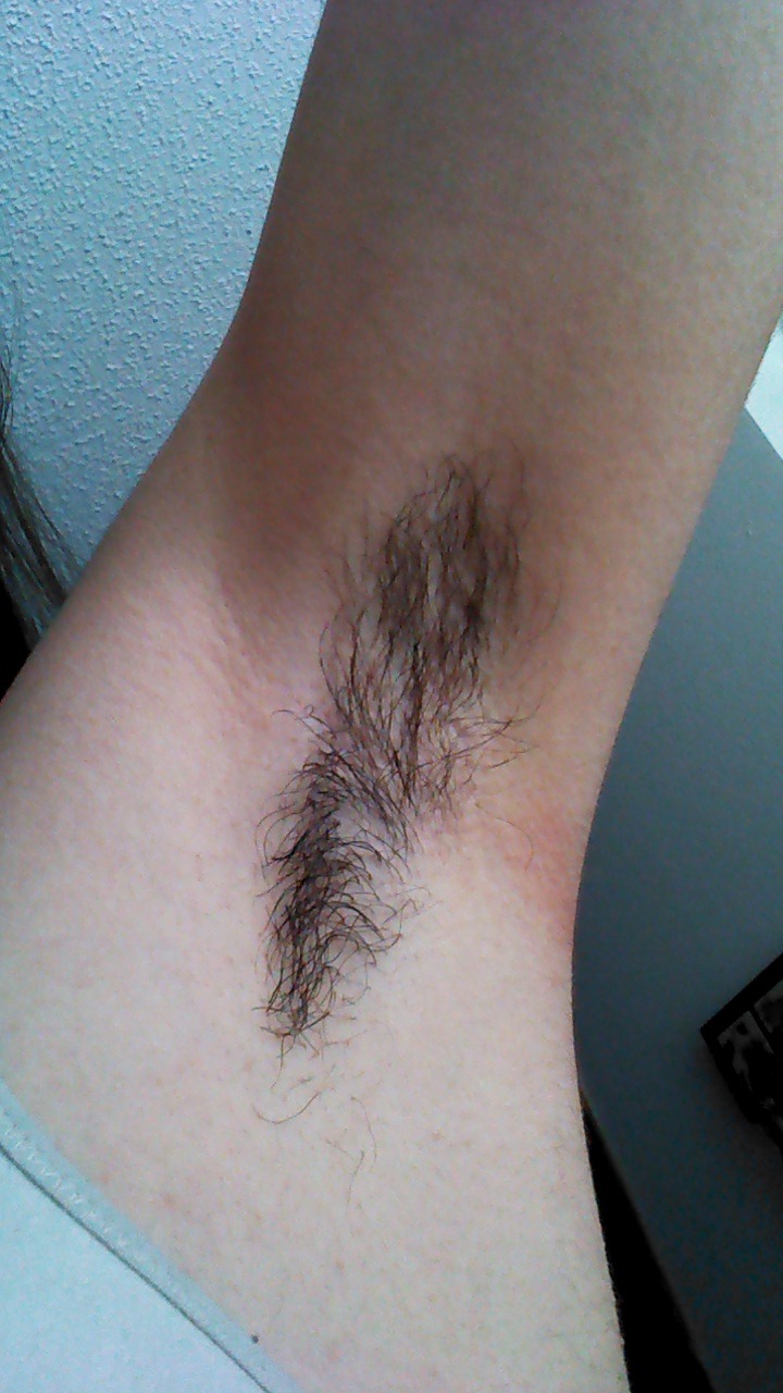 achselhaare:  Der absolute Idealverlauf im No-Shave-November. Und der Vorher-Nachher-Vergleich