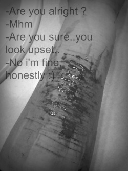 they-watched-her-die:  I’m fine really..