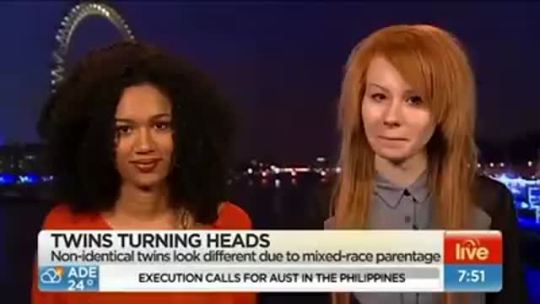 eurotrottest:  gemtothejam:  babycakesbriauna:  stayingwoke:  Today in :When you forget to hide your racism NewsAustralian TV host congratulates a biracial girl for inheriting white skin vs. brown skin.   He honestly couldn’t believe she just did that
