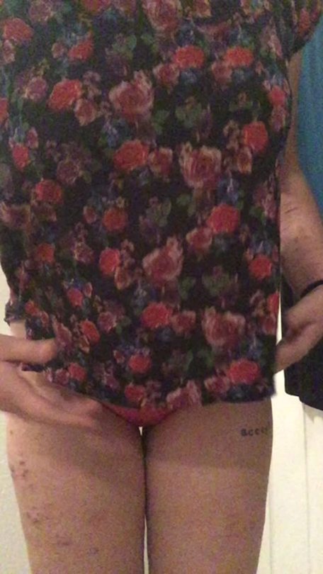 luvabcup:  spoiledrottenbrat:🍒and when I’m lonely, cherry’s there🍒 Feeling bad about my body so I took a cute vid to boost my self esteem lol sexyy titties!!!!