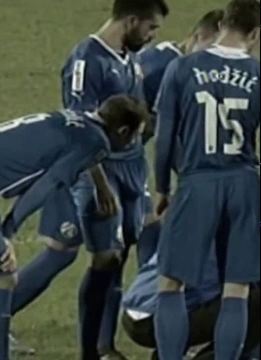 footbulging
