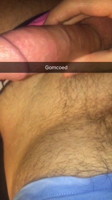 Gomco’d cock!